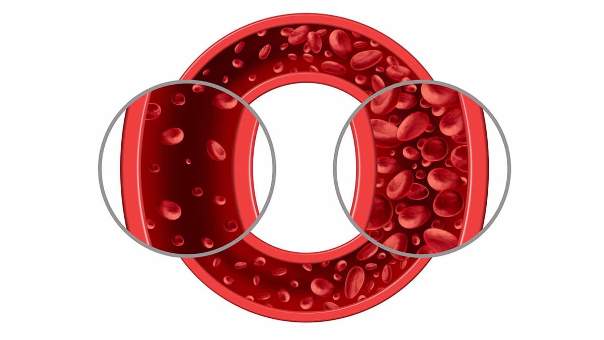 High hemoglobin and its risks