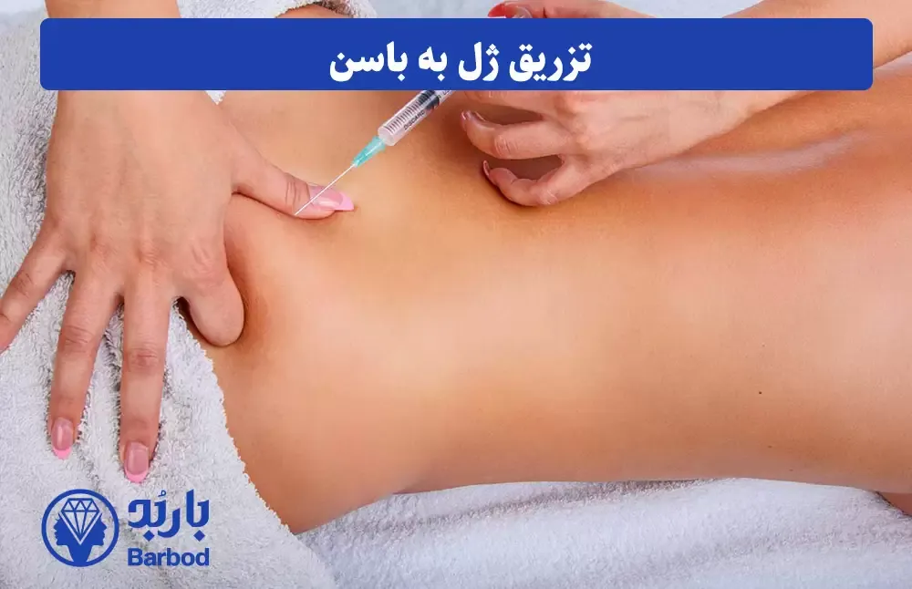 تزریق فیلر باسن