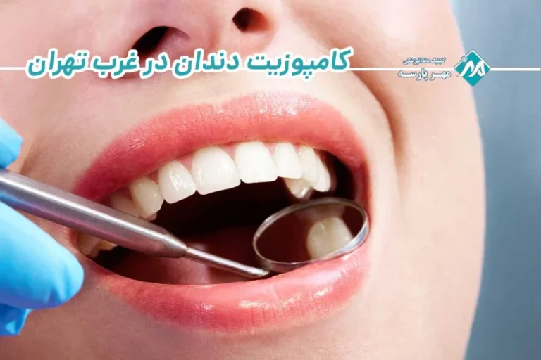 بهترین متخصص کامپوزیت دندان در غرب تهران (کلینیک مهر پارسه)