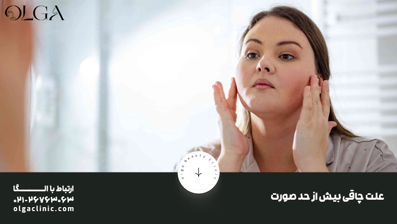 علت چاقی بیش از حد صورت
